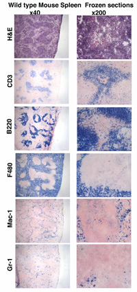 Illustration of visual appearance of spleens stained with different immunohstochemical stains.