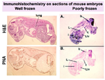Comparison of well frozen and poorly frozen immunohistochemistry